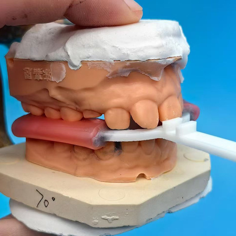 10Pcs/Bag Dental Bite Fork Ort - 3D Printing Orthodontics avaliação e preço
