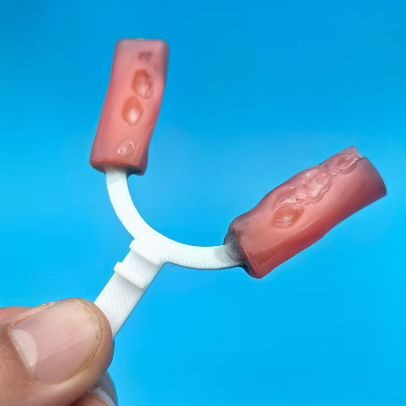 10Pcs/Bag Dental Bite Fork Ort - 3D Printing Orthodontics avaliação e preço